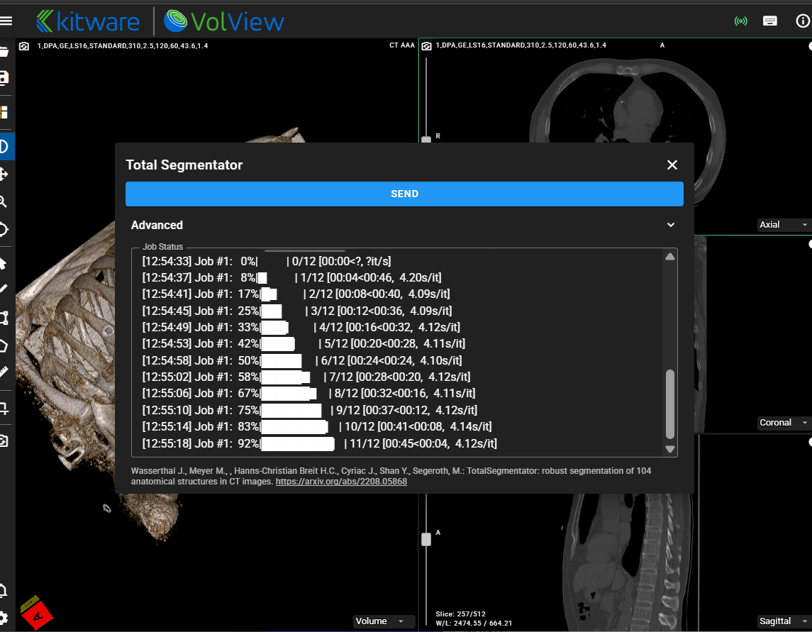 VolView receiving TotalSegmentator results through Cast